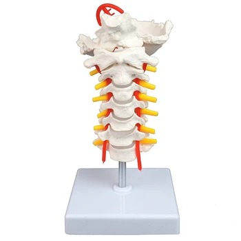Шиен отдел на гръбначния стълб нерви и артериями в реален размер, съчленени 7 шийните прешлени, гръбначния дискове